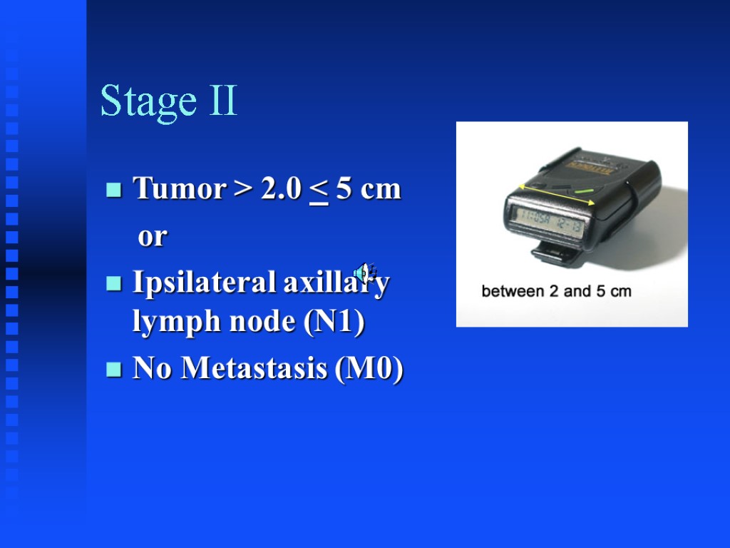 Stage II Tumor > 2.0 < 5 cm or Ipsilateral axillary lymph node (N1)